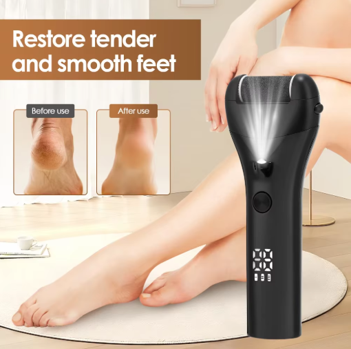 Leviro™ PediSmooth Elite Professional Callus Remover