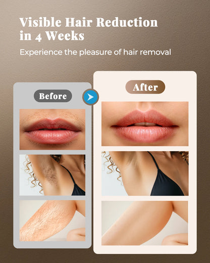 Leviro™ Lumina Permanent IPL & Rejuvenation