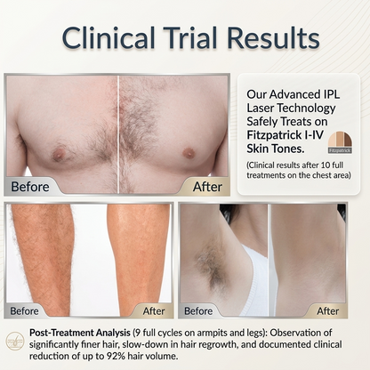 Leviro™ Emerald Pro IPL Hair Removal Device