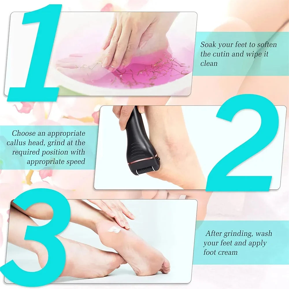 Leviro™ PediSmooth Elite Professional Callus Remover