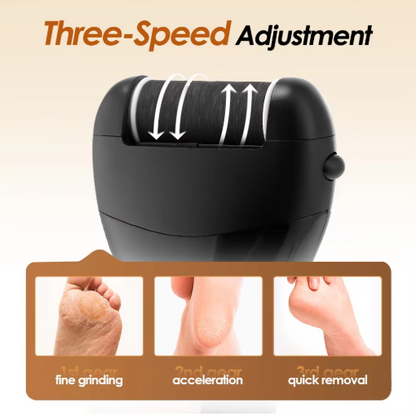 Leviro™ PediSmooth Elite Professional Callus Remover